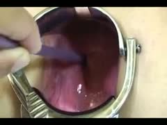 I used a stick to press my wife's stomach and speculum to stretch her asshole.